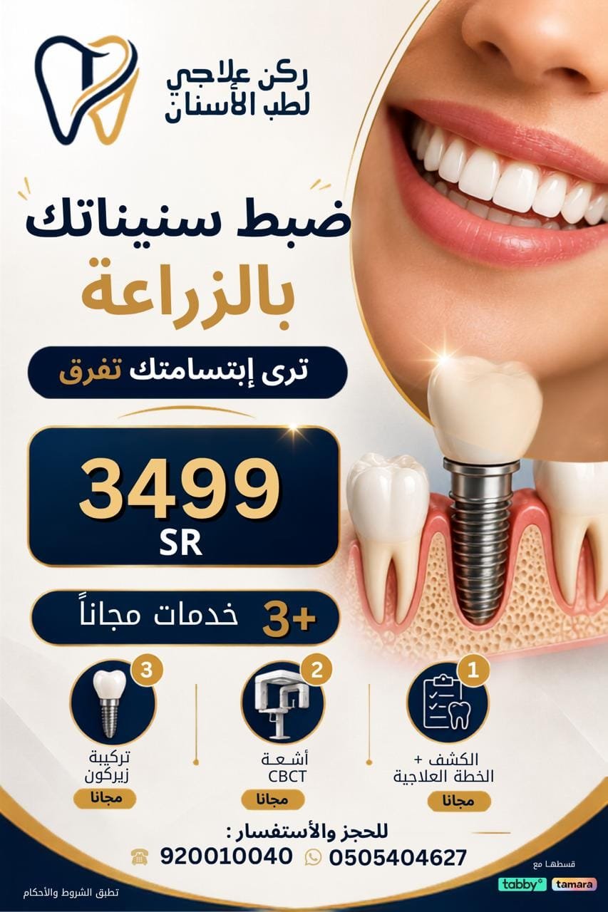 عرض زراعة الأسنان في عيادات ركن علاجي
