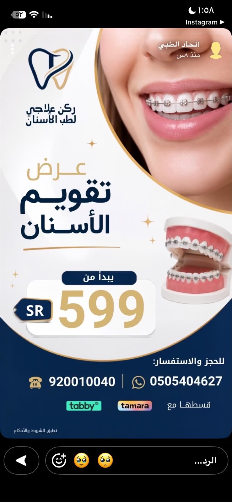 عرض تقويم الأسنان